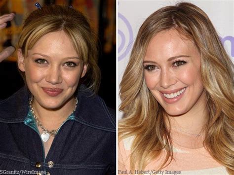 hillary duff nose job|15 Celebrities Who Have Been Honest About Their Nose Jobs